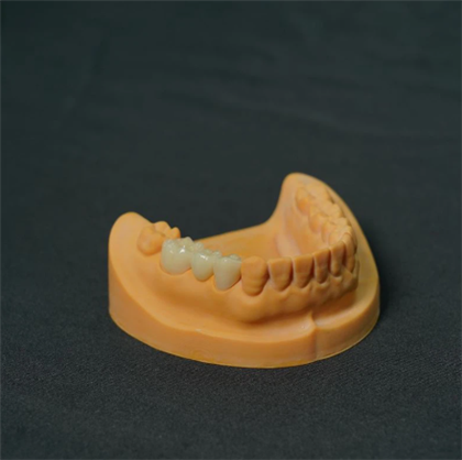 Dentes de porcelana de cobalto-cromo